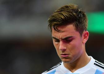 1x1 de Argentina: Dybala e Icardi suspendieron de nuevo