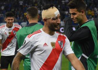 Casco: