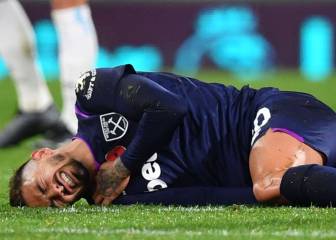 Sigue el calvario de Lanzini: ahora se fractura la clavícula