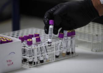 Argentina producirá la vacuna de Oxford: cuándo estará disponible y cuánto costará