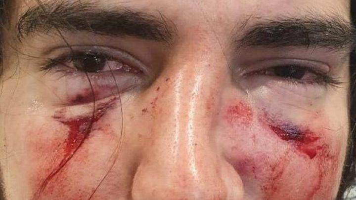 Rugbiers golpearon brutalmente a un joven de 18 años: dos fueron imputados