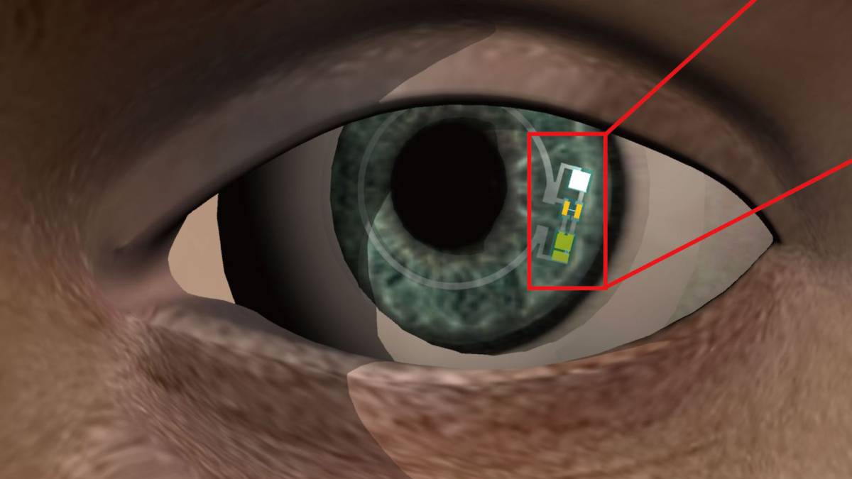 lentilla diabetes