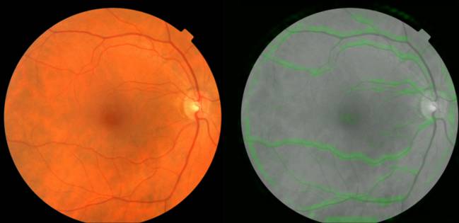 retina google ia