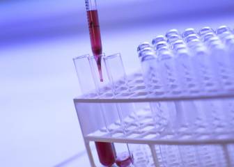 Un tumor en el cerebro podría detectarse con un análisis de sangre