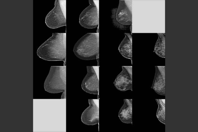 Decenas de miles de mamografías sirven para entrenar a la IA creada