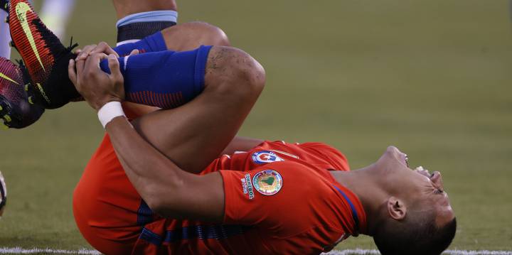 Así quedó el tobillo de Alexis Sánchez tras la final