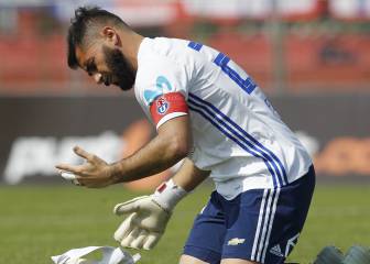 La lesión en la mano de Johnny Herrera que preocupa en la U