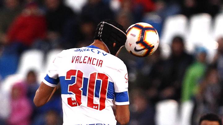 Diego Valencia recordó el lamentable episodio que ocurrió el 28 de junio en San Carlos de Apoquindo, cuando un fierro lo impactó en la cabeza.