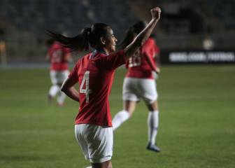 La grave lesión que sufrió una de las figuras de la Roja femenina