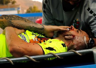 La brutal lesión que marcó el inicio del UC-Palestino