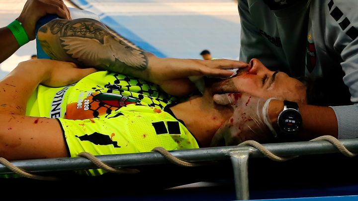 "Me pidió disculpas": la nueva vida del arquero que sufrió un grave accidente ante la UC