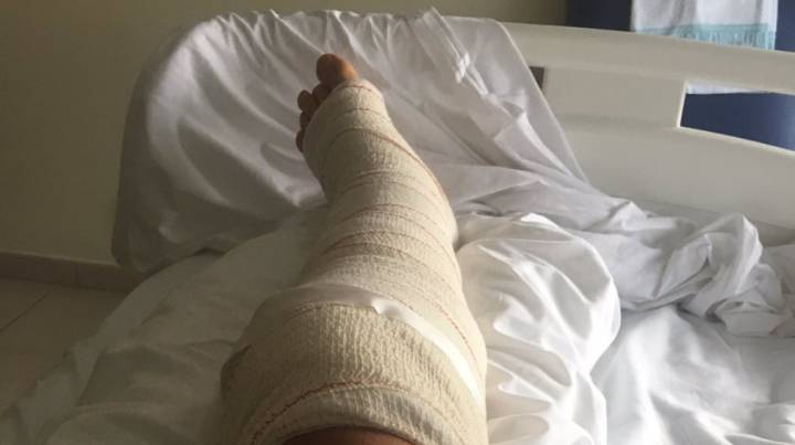 Rojas, operado con éxito de las fracturas que sufrió en la Vuelta