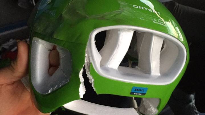 El ciclista italiano del Cannondale-Drapac Davide Formolo muestra su casco partido tras una caída en la París-Niza.