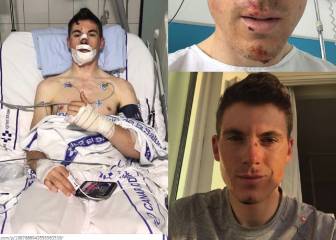 Ben Swift recibe el alta médica tras su lesión en el bazo