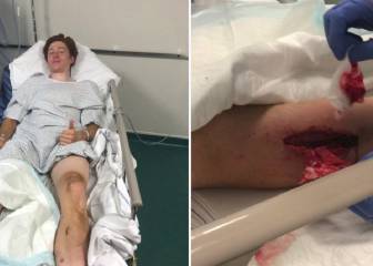 Grave lesión de Jorgenson en Roubaix por un freno de disco