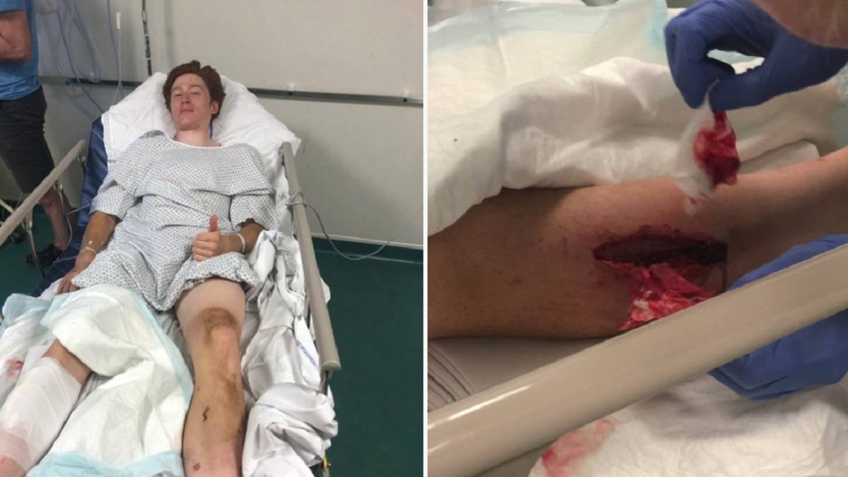 Grave lesión de Jorgenson en Roubaix por un freno de disco