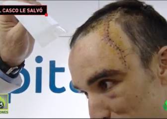 Le salvó la vida el casco: así quedó la cabeza de Maté tras caerse en la misma carrera que Lambrecht