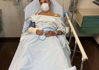 Purito sufre una fuerte caída haciendo mountain bike