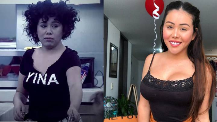 Yina Calderón habló sobre sus 17 cirugías.