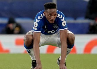 Everton, dificultad para cerrar juegos que lo tendrían en top 4