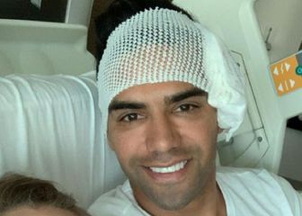 Falcao: