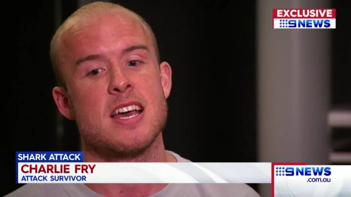Charlie Fry, surfista superviviente a un ataque de tiburón en Australia