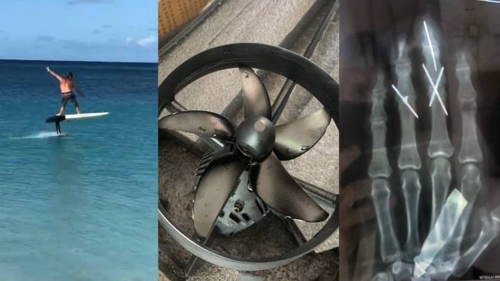 William Aliotti se rebana dos dedos con su foil eléctrico