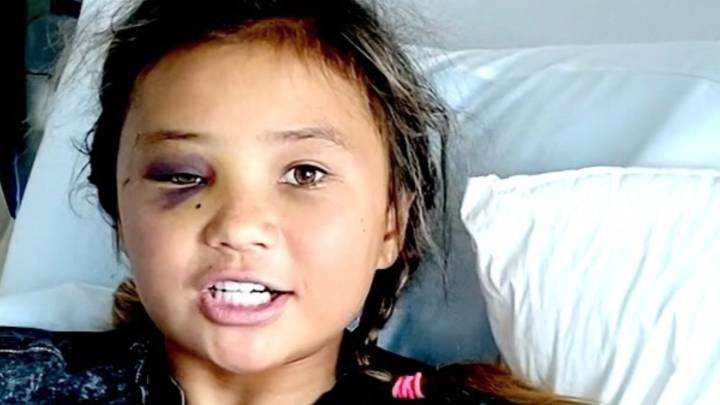 La skater 'influencer' de 11 años se fractura la cabeza y otros huesos en una terrorífica caída