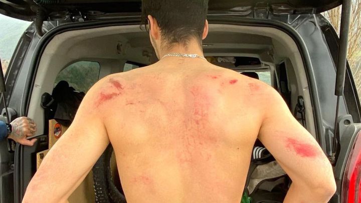 "Tengo 6 costillas rotas, pero me siento afortunado por cómo fue la caída"