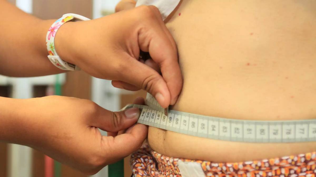 Sobrepeso y obesidad, cómo afecta a la salud Sobrepeso y obesidad, cómo afecta a la salud