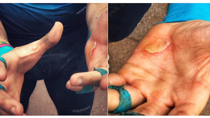 Cómo cuidar las manos tras la mítica Paris-Roubaix