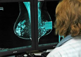 Buenas noticias ante el cáncer: inmunoterapia que cura