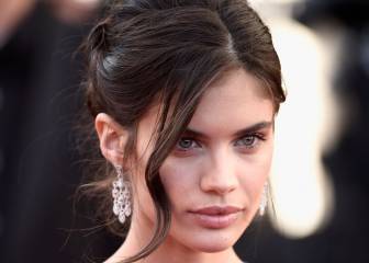 Tricotilomanía: la enfermedad nerviosa de la top Sara Sampaio