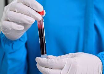 Científicos, alarmados por los graves efectos del coronavirus en sangre