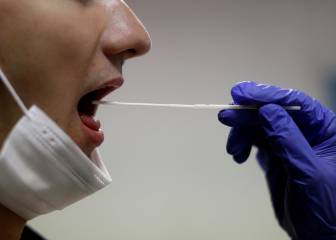 Vigo utiliza los test de saliva que usan en la NBA