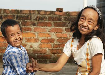 Los hermanos 'Benjamin Button': menores de edad y aparentan tener 80 años