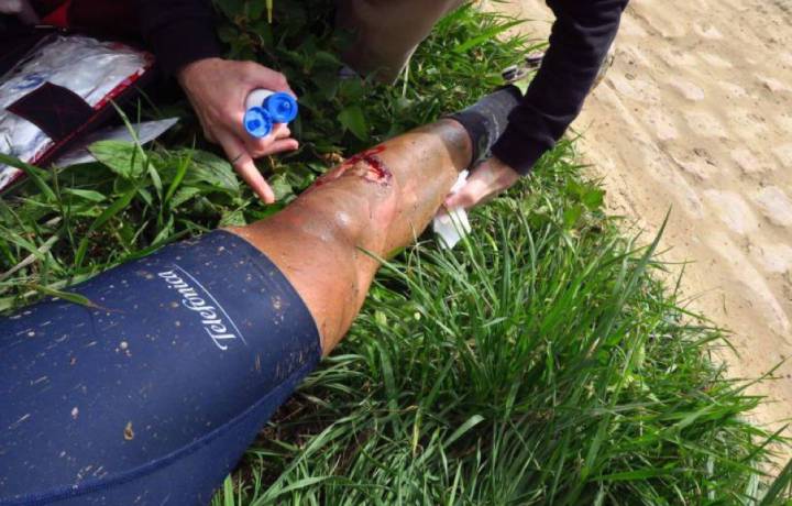 Disc brake injury on Ventoso