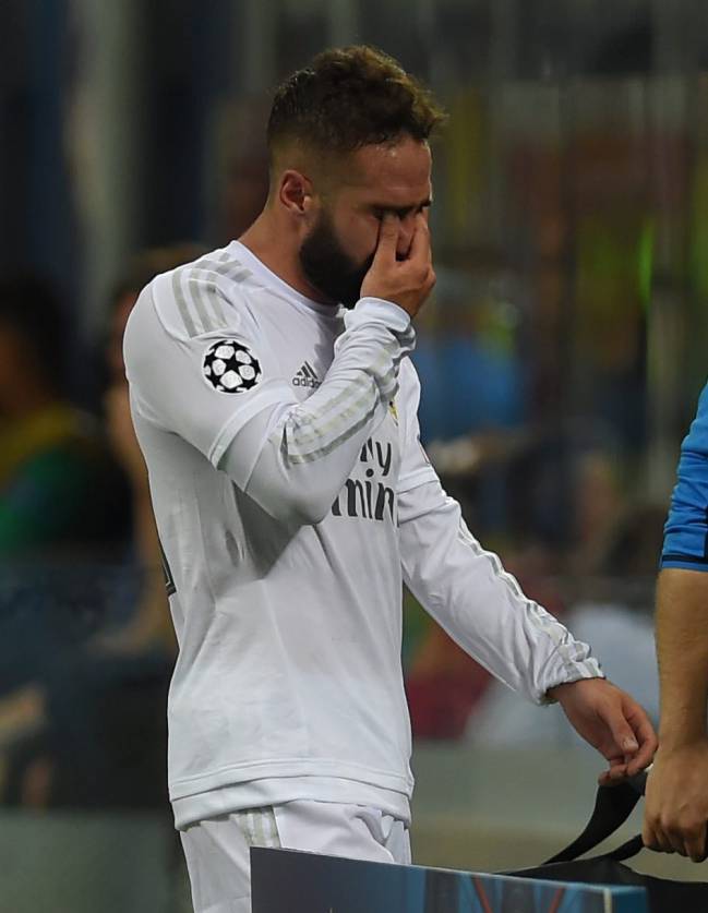 Dani Carvajal in tears as has to leave the Champions League final.