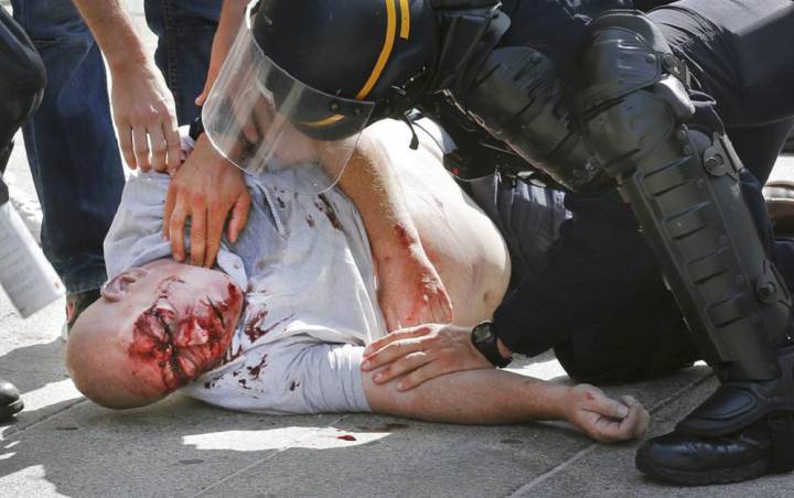 Attempted murder inquiry into England fan beatings at Euro 2016