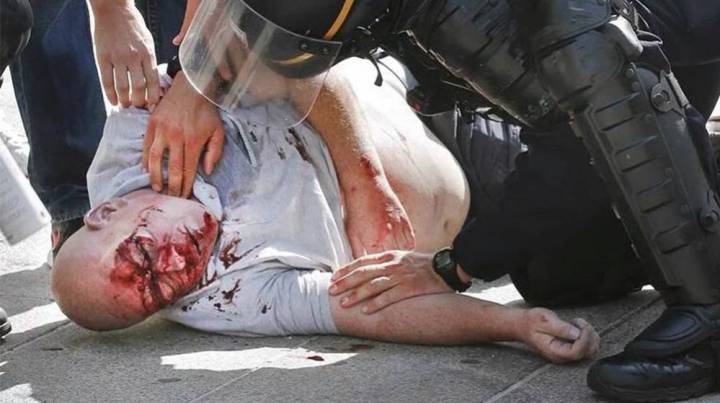 England fans still 'fighting for lives' after 'attempted murder'
