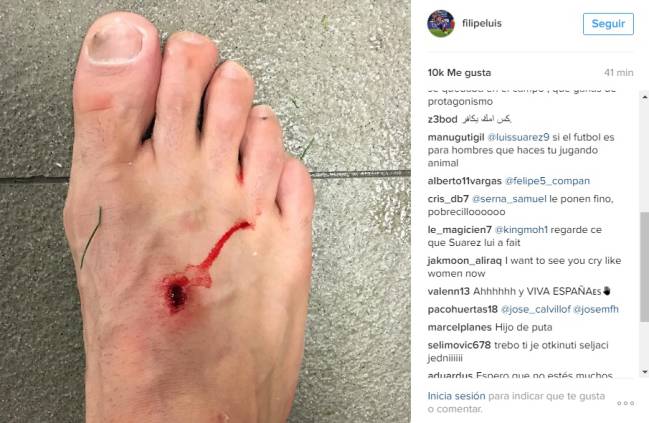 Luis Suárez hits back at Filipe Lius: “Football is a man’s game”