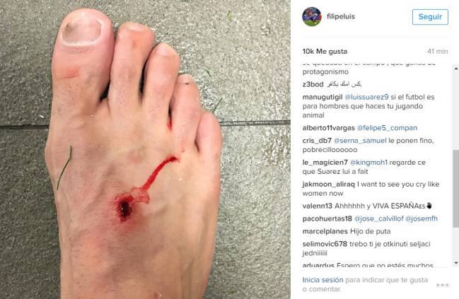 Luis Suárez fouled Filipe Luis then said: "You dived, you clown"