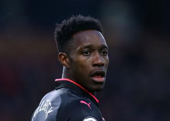 Arsenal forward Welbeck admits injury fears in Ostersunds