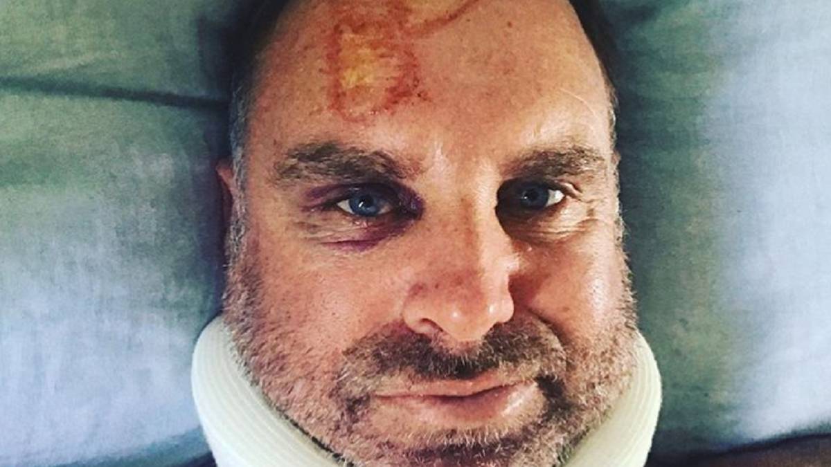 Oz Cricketer Matthew Hayden fractures neck in surfing accident