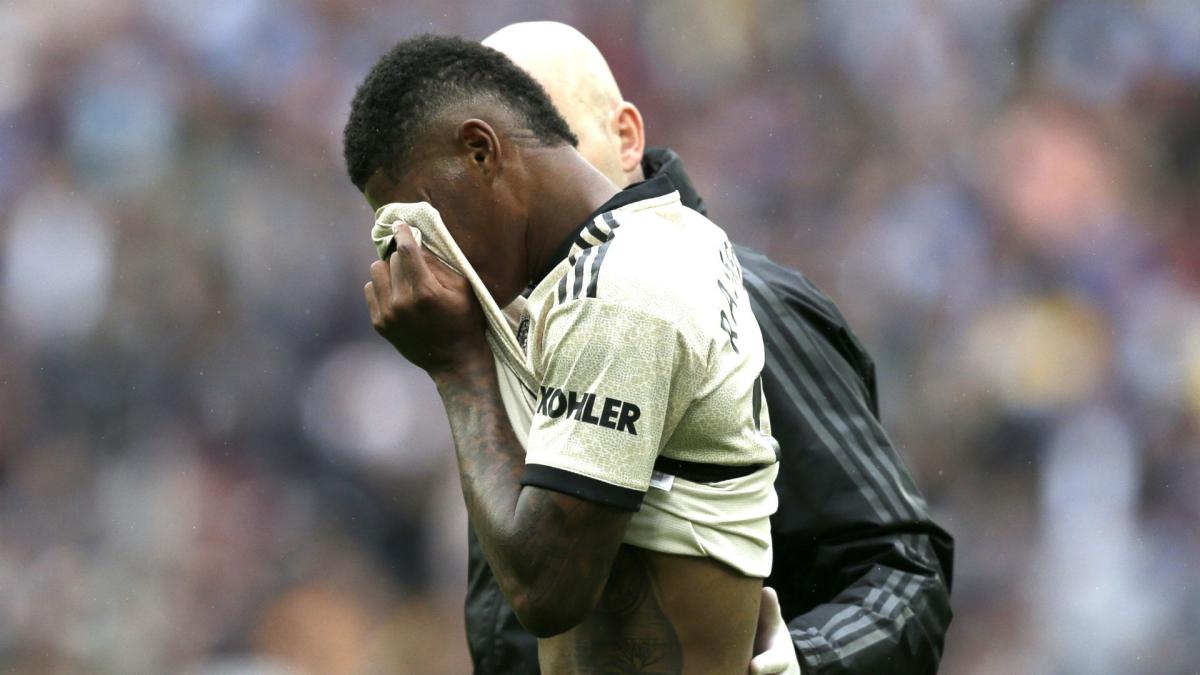 Rashford expected to be 'out for a while' - Solskjaer