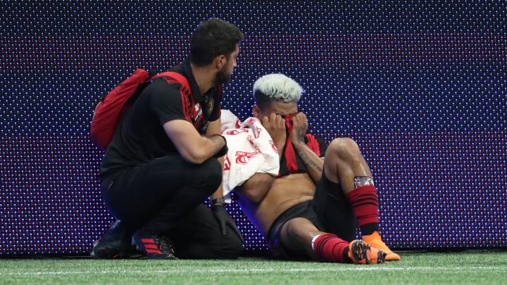 Atlanta United forward Josef Martinez reacts after injuring his right leg in the second half against the San Jose Earthquakes at Mercedes-Benz Stadium.