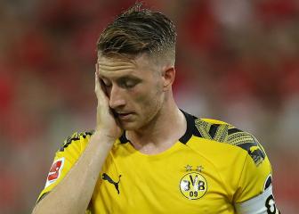 Reus adds to Dortmund's injury woes for Inter clash