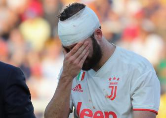 Higuaín returns for Juventus ahead of Derby della Mole