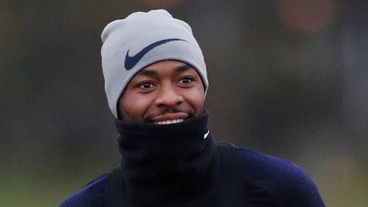 "A broken leg stops Sterling but that's not our style"