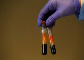 Coronavirus vaccine trial could be finished by August, says professor